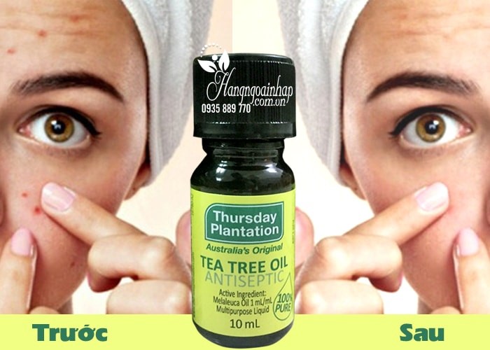 Tinh dầu trà trị mụn tea tree oil của Thursday Plantation